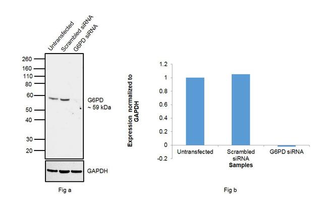 G6PD Antibody in Western Blot (WB)