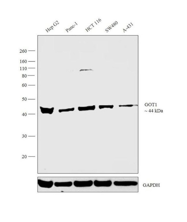 GOT1 Antibody