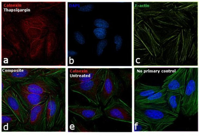 Calnexin Antibody in Immunocytochemistry (ICC/IF)