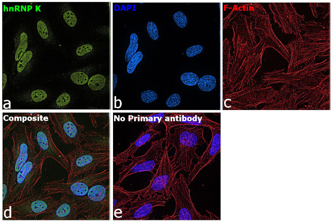 hnRNP K Antibody in Immunocytochemistry (ICC/IF)