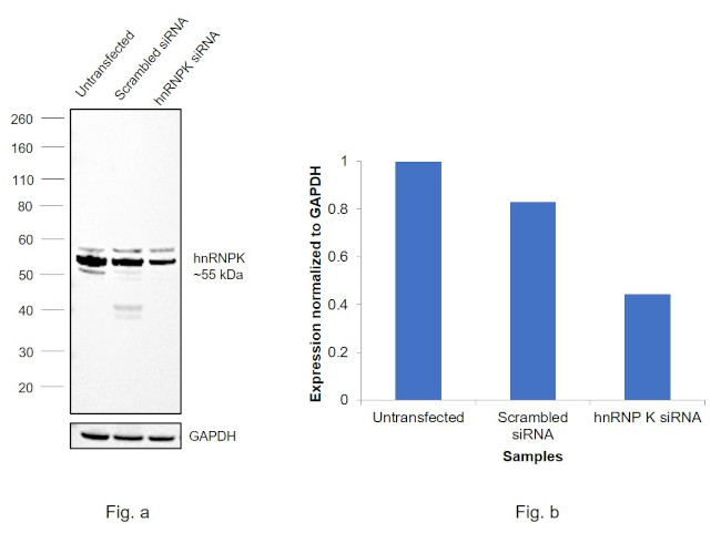 hnRNP K Antibody