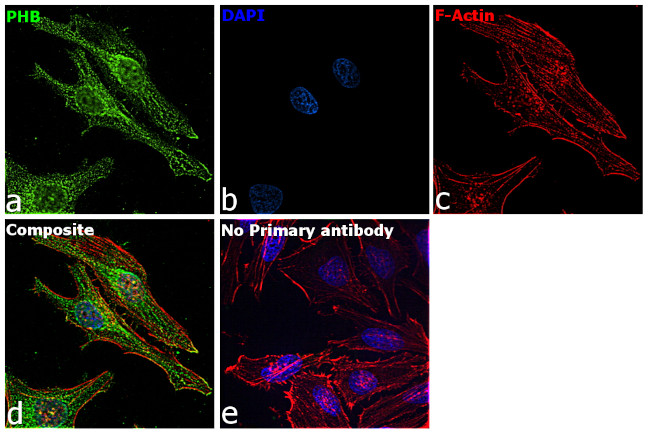 Prohibitin Antibody in Immunocytochemistry (ICC/IF)