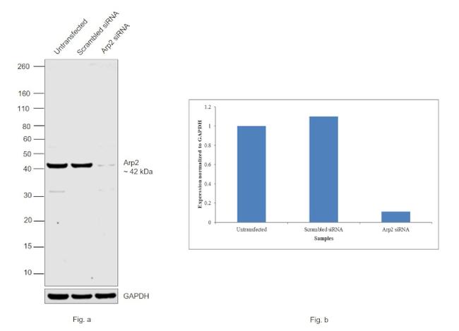 Arp2 Antibody in Western Blot (WB)