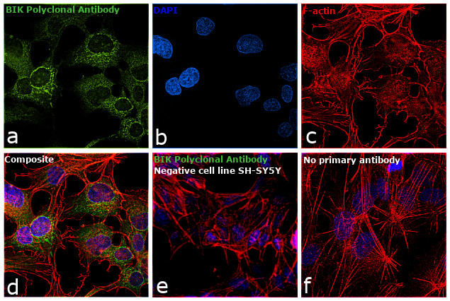 BIK Antibody in Immunocytochemistry (ICC/IF)