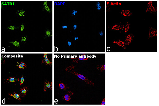 SATB1 Antibody in Immunocytochemistry (ICC/IF)