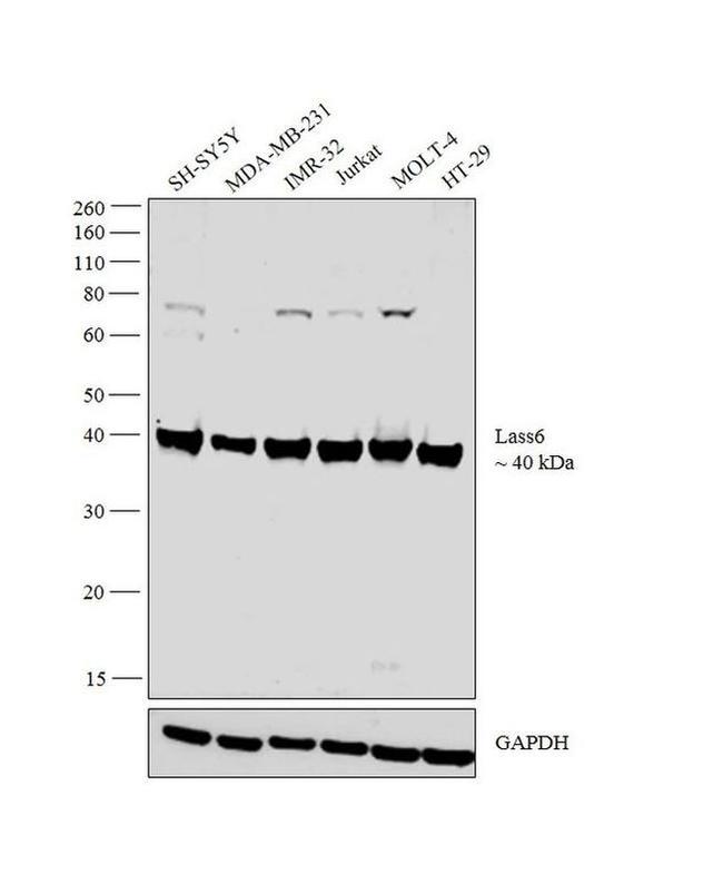 Lass6 Antibody in Western Blot (WB)