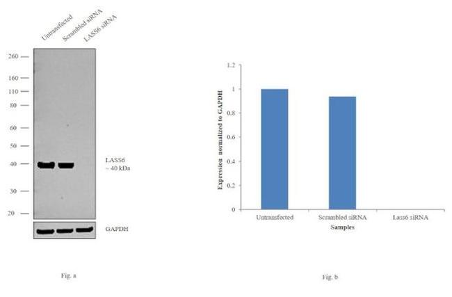 Lass6 Antibody in Western Blot (WB)