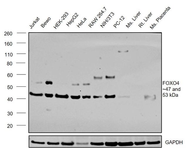 FOXO4 Antibody in Western Blot (WB)