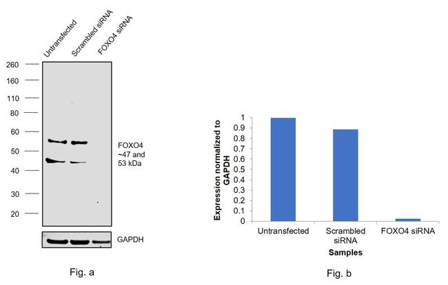 FOXO4 Antibody in Western Blot (WB)