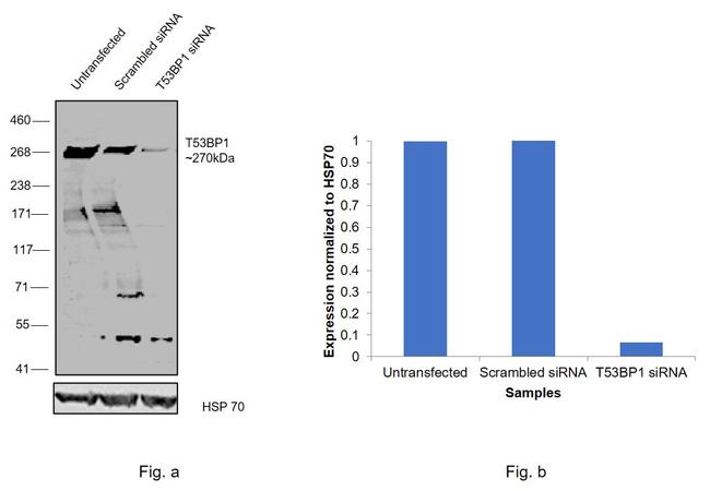 53BP1 Antibody in Western Blot (WB)