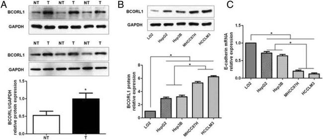 BCORL1 Antibody in Western Blot (WB)