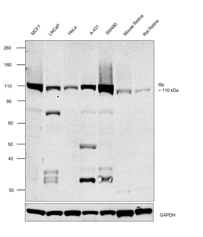 Rb Antibody in Western Blot (WB)