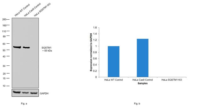 SQSTM1 Polyclonal Antibody (PA5-27247)