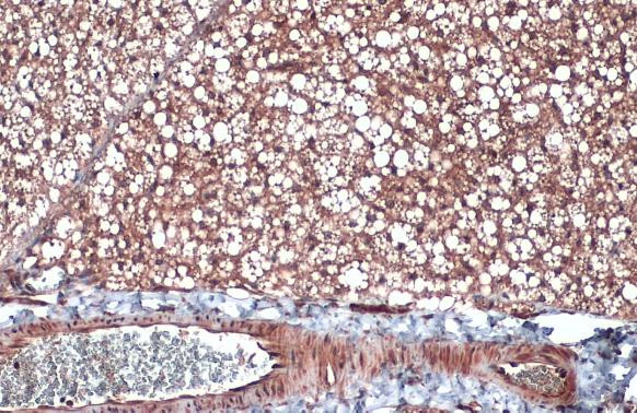 Apolipoprotein D Antibody in Immunohistochemistry (Paraffin) (IHC (P))