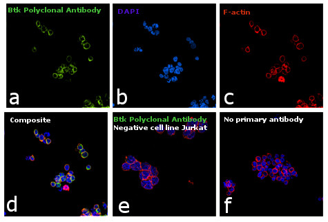 Btk Antibody in Immunocytochemistry (ICC/IF)