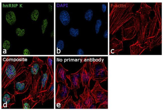 hnRNP K Antibody in Immunocytochemistry (ICC/IF)