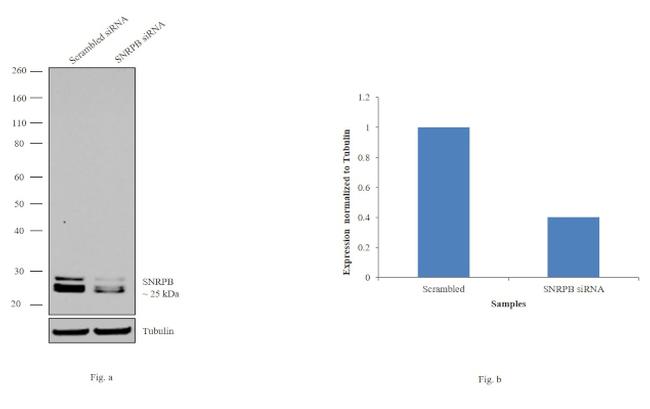 SNRPB Antibody in Western Blot (WB)