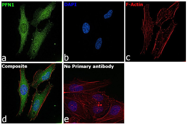 Profilin 1 Antibody in Immunocytochemistry (ICC/IF)