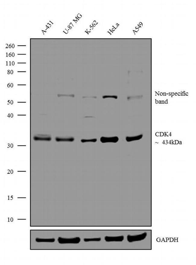 CDK4 Antibody in Western Blot (WB)