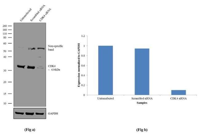 CDK4 Antibody in Western Blot (WB)