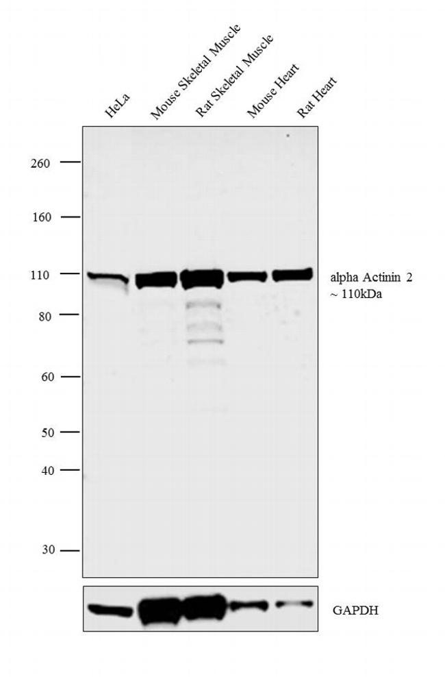 alpha Actinin 2 Antibody in Western Blot (WB)