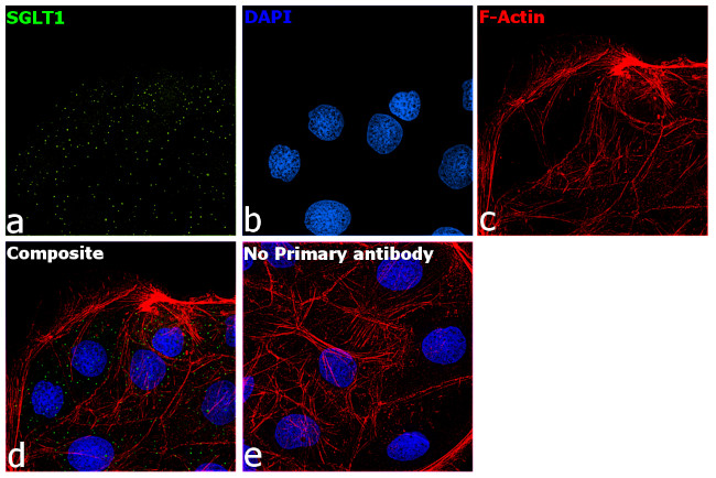 SGLT1 Antibody in Immunocytochemistry (ICC/IF)