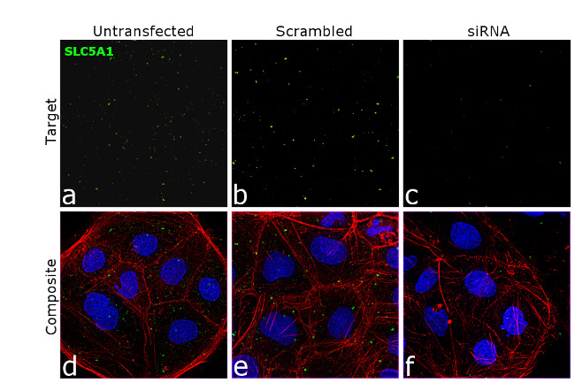 SGLT1 Antibody