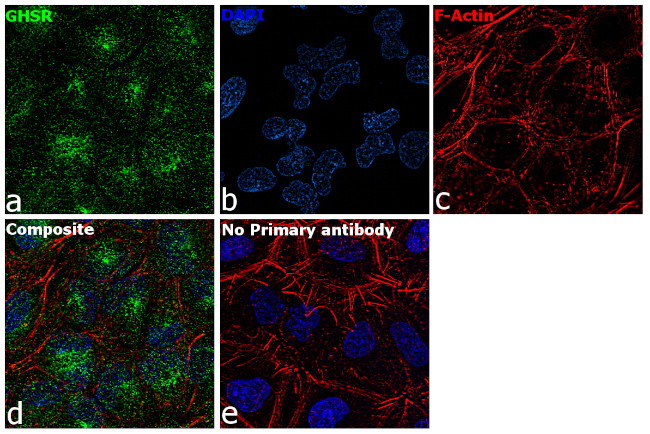 GHSR Antibody in Immunocytochemistry (ICC/IF)