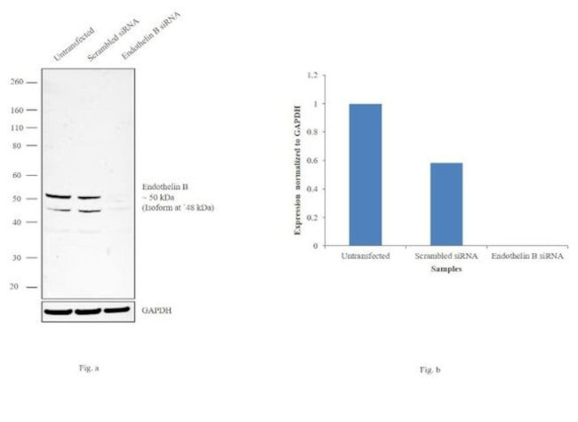 Endothelin B Receptor Antibody