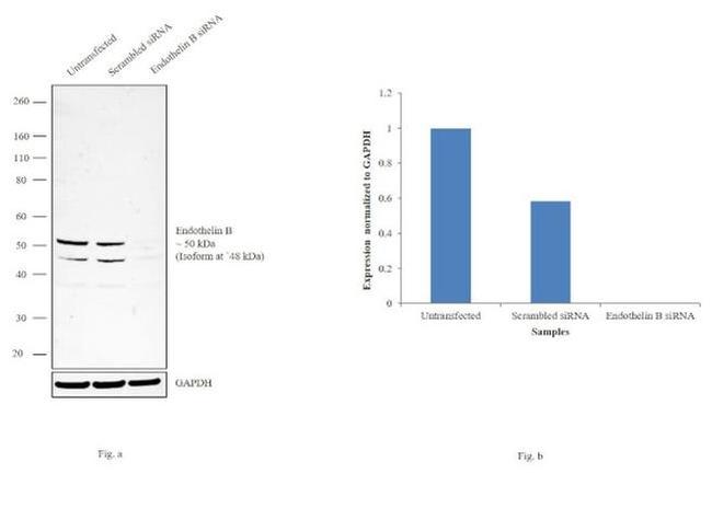 Endothelin B Receptor Antibody in Western Blot (WB)