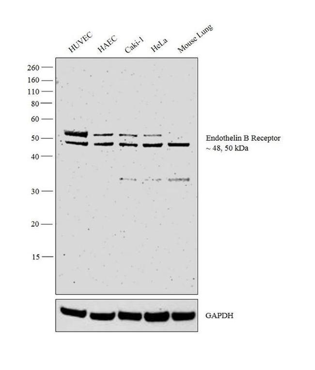 Endothelin B Receptor Antibody in Western Blot (WB)