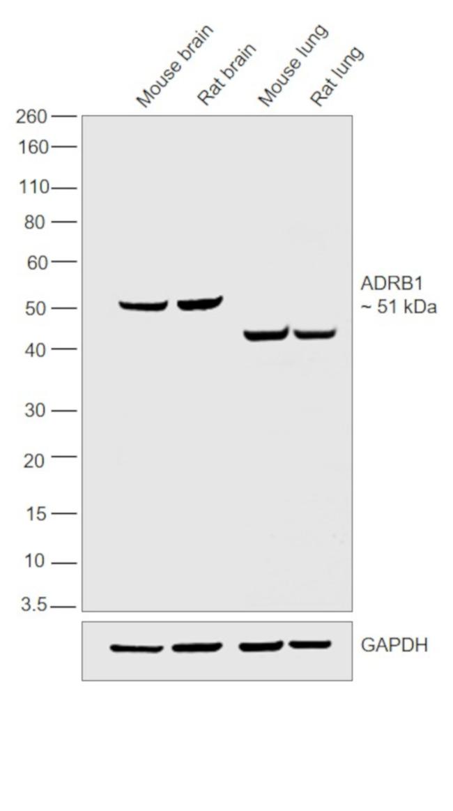 beta-1 Adrenergic Receptor Antibody in Western Blot (WB)