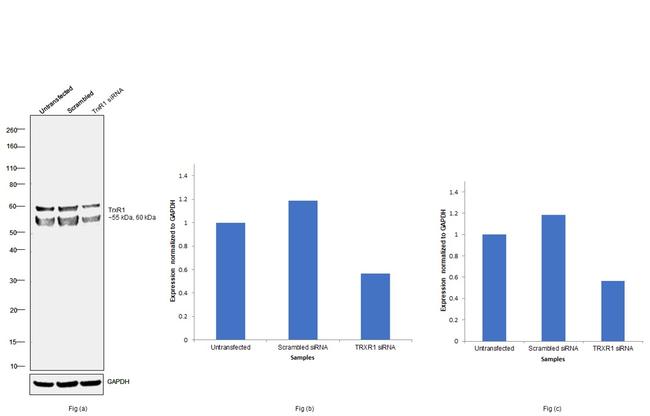 TrxR1 Antibody in Western Blot (WB)