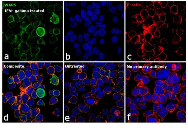 WARS Antibody in Immunocytochemistry (ICC/IF)