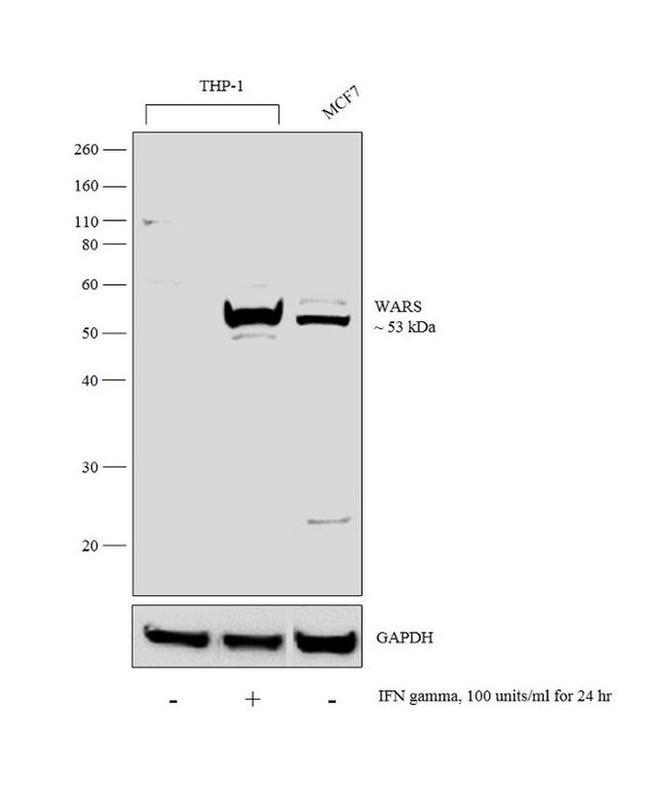 WARS Antibody in Western Blot (WB)