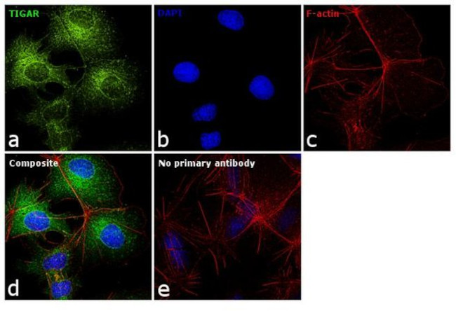 TIGAR Antibody in Immunocytochemistry (ICC/IF)