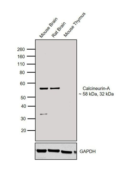 Calcineurin A Antibody