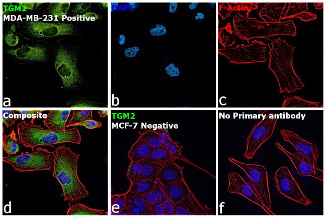 TGM2 Antibody in Immunocytochemistry (ICC/IF)