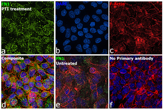 Fibronectin Antibody in Immunocytochemistry (ICC/IF)