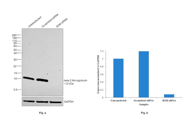 beta-2 Microglobulin Polyclonal Antibody (PA5-29580)