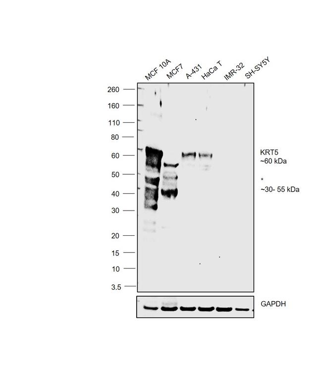 Cytokeratin 5 Antibody in Western Blot (WB)