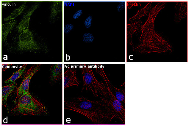 Vinculin Antibody in Immunocytochemistry (ICC/IF)