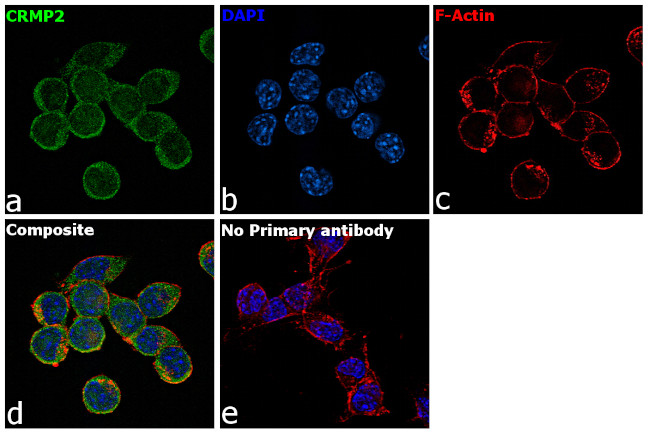 CRMP2 Antibody in Immunocytochemistry (ICC/IF)