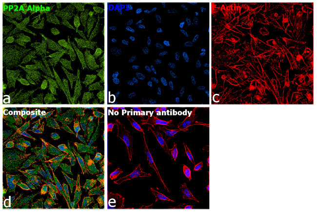 PP2A alpha Antibody in Immunocytochemistry (ICC/IF)