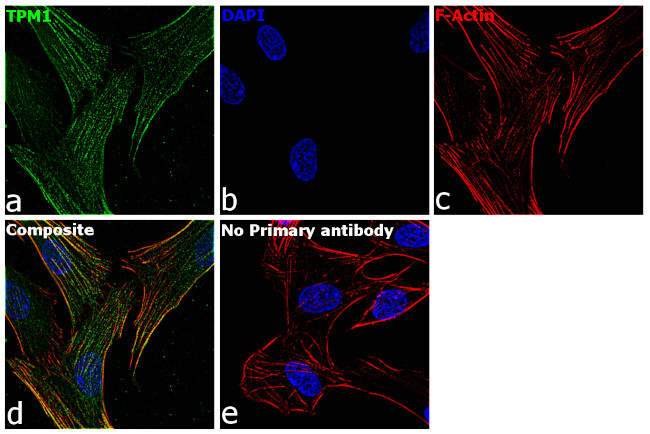 TPM1 Antibody in Immunocytochemistry (ICC/IF)