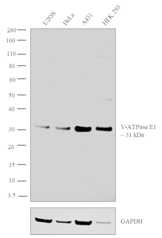 V-ATPase E1 Antibody in Western Blot (WB)