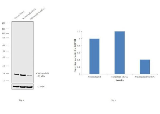 Calcineurin B Antibody