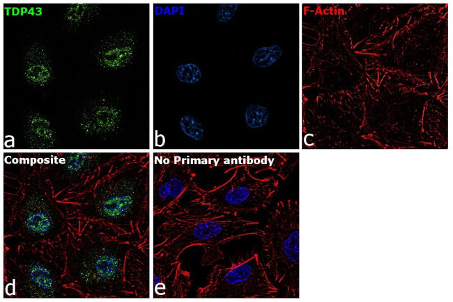 TDP-43 Antibody in Immunocytochemistry (ICC/IF)