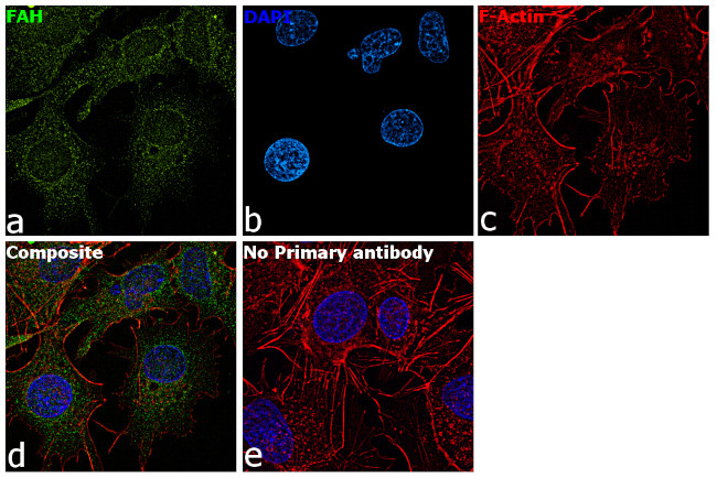 FAH Antibody in Immunocytochemistry (ICC/IF)