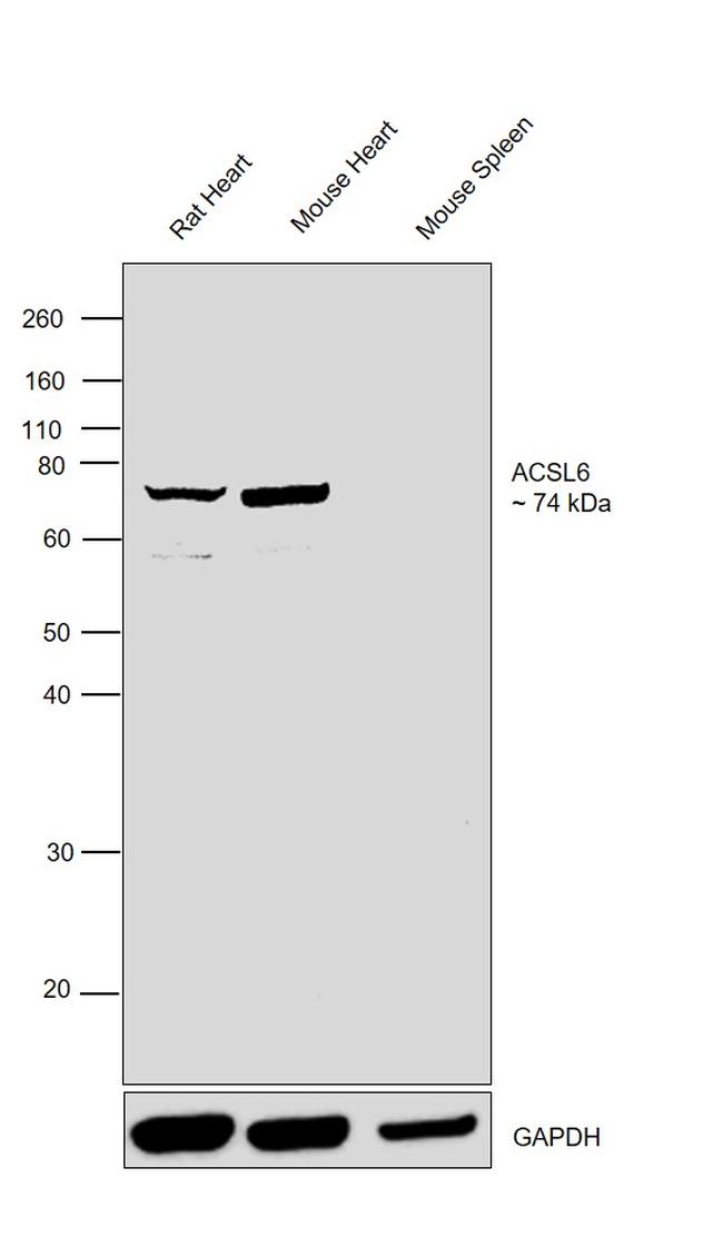 ACSL6 Antibody in Western Blot (WB)